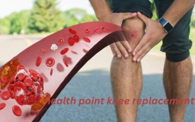 The Ultimate Guide to Acibadem Health Point Knee Replacement