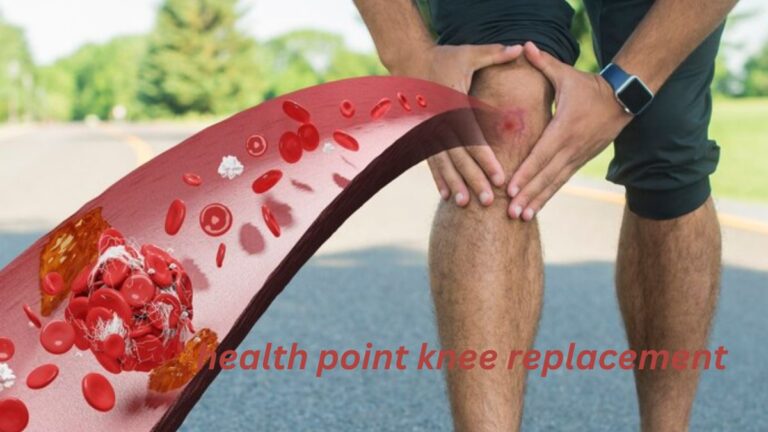 The Ultimate Guide to Acibadem Health Point Knee Replacement